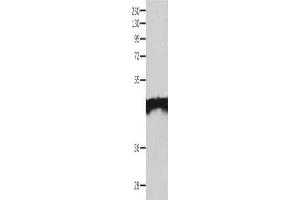 Gel: 10 % SDS-PAGE, Lysate: 40 μg, Lane: Jurkat cells, Primary antibody: ABIN7130184(MAT1A Antibody) at dilution 1/200, Secondary antibody: Goat anti rabbit IgG at 1/8000 dilution, Exposure time: 2 minutes (MAT1A 抗体)
