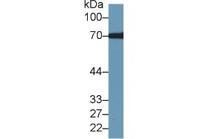 Detection of TKT in Human Hela cell lysate using Polyclonal Antibody to Transketolase (TKT) (TKT 抗体  (AA 1-286))