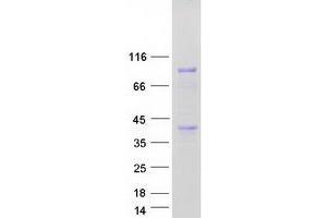 Western Blotting (WB) image for Ankyrin Repeat and Zinc Finger Domain Containing 1 (ANKZF1) (Transcript Variant 2) protein (Myc-DYKDDDDK Tag) (ABIN2714727)