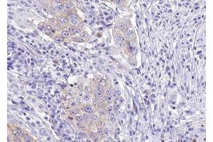 Immunohistochemistry (IHC) image for anti-WNK Lysine Deficient Protein Kinase 1 (WNK1) (pThr60) antibody (ABIN6256585)