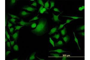 Immunofluorescence of monoclonal antibody to PBK on HeLa cell. (PBK 抗体  (AA 1-110))