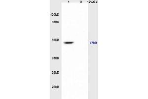 Lane 1: mouse brain lysates Lane 2: mouse heart lysates probed with Anti kir 6. (KCNJ8 抗体  (AA 61-160))