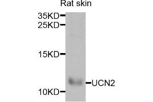 Western blot analysis of extracts of rat skin cells, using UCN2 antibody. (Urocortin 2 抗体)