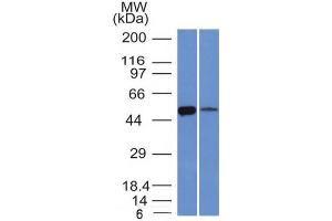 Western Blot of K562 and Lung lysate ALDH1A1 Mouse Monoclonal Antibody (ALDH1A1/1381). (ALDH1A1 抗体  (AA 315-434))