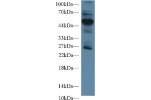 Detection of RAGE in Mouse Lung lysate using Polyclonal Antibody to Receptor For Advanced Glycation Endproducts (RAGE) (RAGE 抗体  (AA 91-274))