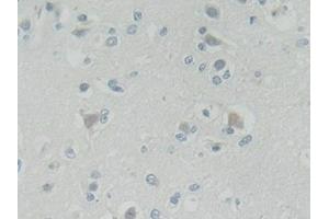 Detection of ROR2 in Human Cerebrum Tissue using Polyclonal Antibody to Receptor Tyrosine Kinase Like Orphan Receptor 2 (ROR2) (ROR2 抗体  (AA 683-934))