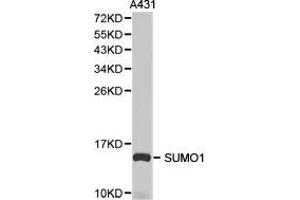 Western Blotting (WB) image for anti-Small Ubiquitin Related Modifier Protein 1 (SUMO1) antibody (ABIN1874993) (SUMO1 抗体)