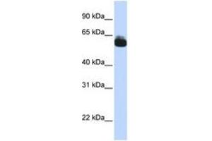 Image no. 1 for anti-Frizzled Family Receptor 9 (FZD9) (AA 144-193) antibody (ABIN6740722) (FZD9 抗体  (AA 144-193))