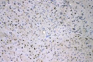 IHC analysis of ADO using anti-ADO antibody (ABIN4886431).