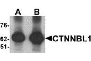 Western blot analysis of CTNNBL1 in human brain tissue lysate with CTNNBL1 antibody at (A) 1 and (B) 2 μg/ml. (CTNNBL1 抗体  (C-Term))