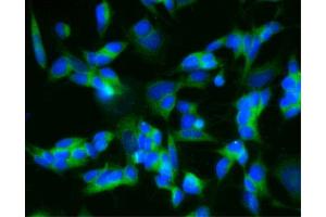 Immunofluorescent staining of SH-SY5Y cells (Second Panel). (CPE 抗体  (AA 49-200))
