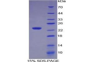 SDS-PAGE analysis of Human Matrix Metalloproteinase 3 (MMP3) Protein. (MMP3 蛋白)