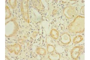 Immunohistochemistry of paraffin-embedded human kidney tissue using ABIN7154273 at dilution of 1:100 (GPC4 抗体  (AA 19-210))
