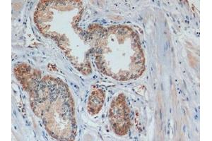 Immunohistochemistry (IHC) image for anti-Keratin 19 (KRT19) (AA 245-391) antibody (ABIN7427978)