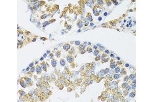 Immunohistochemistry of paraffin-embedded Mouse testis using POLG2 Polyclonal Antibody at dilution of 1:100 (40x lens).