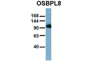 Host:  Rabbit  Target Name:  OSBPL8  Sample Type:  HT1080  Antibody Dilution:  1. (OSBPL8 抗体  (Middle Region))