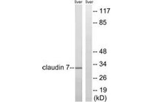 Western blot analysis of extracts from rat liver cells, using Claudin 7 (Ab-210) Antibody. (Claudin 7 抗体  (AA 162-211))