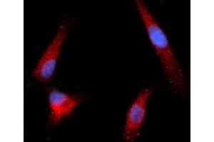 Immunofluorescence (IF) image for anti-Granzyme B (GZMB) (AA 21-247) antibody (APC) (ABIN5564760) (GZMB 抗体  (AA 21-247) (APC))