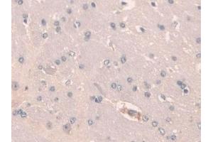 Immunohistochemistry (IHC) image for anti-Secretagogin, EF-Hand Calcium Binding Protein (SCGN) (AA 1-276) antibody (ABIN7436366)