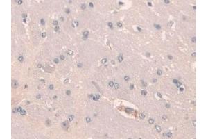 Detection of SCGN in Mouse Cerebrum Tissue using Polyclonal Antibody to Secretagogin (SCGN) (SCGN 抗体  (AA 1-276))