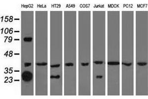 Western blot analysis of extracts (35 µg) from 9 different cell lines by using anti-QPRT monoclonal antibody. (QPRT 抗体)