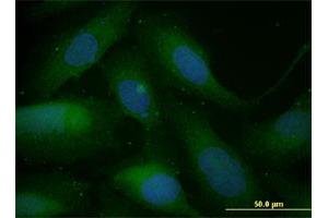 Immunofluorescence of monoclonal antibody to SNAI1 on U-2 OS cell. (SNAIL 抗体  (AA 121-230))
