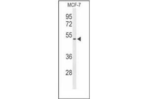 Western Blotting (WB) image for anti-Feline Leukemia Virus Subgroup C Cellular Receptor Family, Member 2 (FLVCR2) (AA 485-515), (C-Term) antibody (ABIN952343)