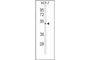 Western blot analysis of FLVC2 Antibody (C-term) in MCF-7 cell line lysates (35ug/lane). (FLVCR2 抗体  (C-Term))