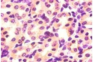 Immunohistochemistry of paraffin-embedded mouse kidney tissue using ABIN7176944 at dilution of 1:50 (Angiopoietin 2 抗体  (AA 19-483))