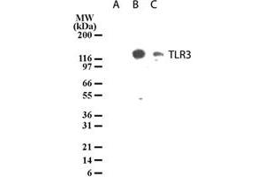 Western blot analysis of TLR3 in lysates from untransfected 293 cells (lane A), 293 cells transfected with human TLR3 cDNA (lane B), and 20 ug/lane human intestine tissue lysate (lane C). (TLR3 抗体  (AA 55-85))