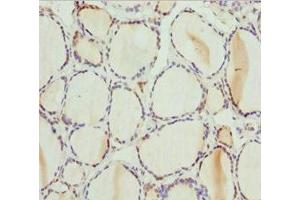 Immunohistochemistry of paraffin-embedded human thyroid tissue using ABIN7163421 at dilution of 1:100 (PSPH 抗体  (AA 1-225))
