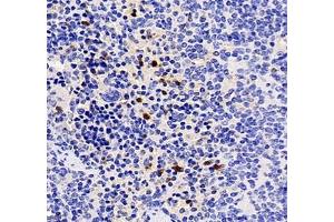 Immunohistochemistry of paraffin embedded mouse spleen using CXCR1 (ABIN7073465) at dilution of 1: 2000 (400x lens) (CXCR1 抗体)