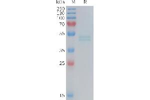 SDS-PAGE (SDS) image for Interleukin 11 Receptor, alpha (IL11RA) (AA 26-367) protein (His tag) (ABIN7538339)