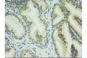 Immunohistochemical staining of paraffin-embedded Human prostate tissue using anti-C17orf28 mouse monoclonal antibody. (HID1/DMC1 抗体)