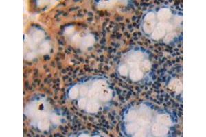 Used in DAB staining on fromalin fixed paraffin-embedded rectum tissue (SBEM 抗体  (AA 21-90))