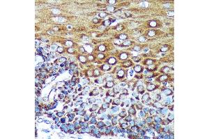 Immunohistochemistry (IHC) image for anti-Sperm Antigen with Calponin Homology and Coiled-Coil Domains 1-Like (SPECC1L) (AA 200-500) antibody (ABIN7270521)