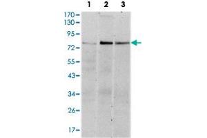 Western blot analysis using RPS6KA3 monoclonal antobody, clone 4E10  against HeLa (1), MCF-7 (2), and HepG2 (3) cell lysate.
