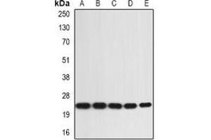 Western blot analysis of IL-36A expression in SW480 (A), A431 (B), mouse skin (C), mouse heart (D), rat liver (E) whole cell lysates. (IL36A/IL1F6 抗体)