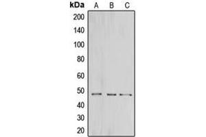 Western blot analysis of CNPase expression in HeLa (A), mouse brain (B), rat brain (C) whole cell lysates. (Cnpase 抗体  (Center))