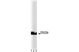 Western blot analysis of caveolin-1 (pY14) on lysates from A431 cells (Human epithelial carcinoma, ATCC CRL-1555) treated with 100 ng/mL EGF. (Caveolin 抗体  (pTyr14))