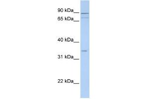 WB Suggested Anti-TNMD Antibody Titration:  0. (TNMD 抗体  (Middle Region))