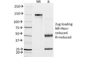 SDS-PAGE (SDS) image for anti-Calponin 1 (CNN1) antibody (ABIN6939161)