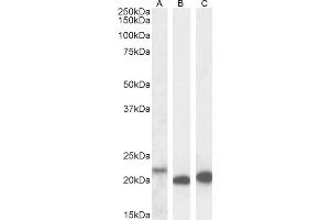 (ABIN570987) (0. (IL-18 抗体  (Internal Region))