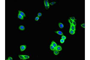 Immunofluorescent analysis of HepG2 cells using ABIN7154928 at dilution of 1:100 and Alexa Fluor 488-congugated AffiniPure Goat Anti-Rabbit IgG(H+L) (GUCY2C 抗体  (AA 636-891))