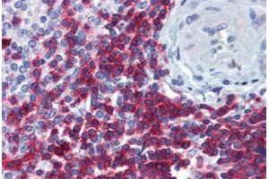 Human Spleen: Formalin-Fixed, Paraffin-Embedded (FFPE) (CD247 抗体  (AA 1-165))