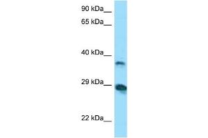 Host:  Rabbit  Target Name:  VSIG4  Sample Tissue:  Human COLO205 Whole Cell  Antibody Dilution:  1ug/ml (VSIG4 抗体  (N-Term))