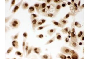 ICC testing of FFPE human PC-3 cells with DDB1 antibody. (DDB1 抗体  (AA 1011-1140))