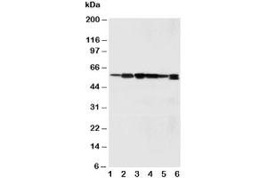 Western blot testing of SSH3BP1 antibody and Lane 1:  rat liver (ABI1 抗体  (C-Term))