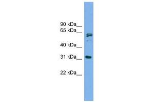 Western Blotting (WB) image for anti-MIT, Microtubule Interacting and Transport, Domain Containing 1 (MITD1) (Middle Region) antibody (ABIN2785028)
