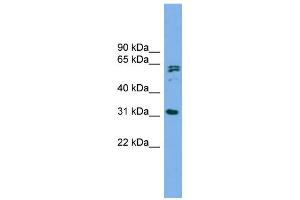 WB Suggested Anti-MITD1 Antibody Titration: 0. (MITD1 抗体  (Middle Region))